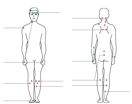 Punctele clasice de acupunctură, aşa-numitele "meridiane", unde se aplică acupunctura.